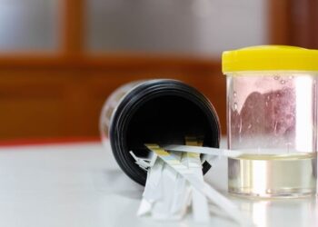 Màu nước tiểu thay đổi nói lên điều gì về tình trạng sức khỏe của bạn?