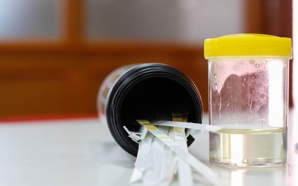 Màu nước tiểu thay đổi nói lên điều gì về tình trạng sức khỏe của bạn?