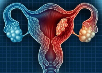 TRẢ BÀI – Ung thư buồng trứng: Người phụ nữ qua đời sau 8 ngày được chuẩn đoán mắc bệnh